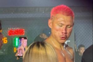 🤯骨折了？恶鼠被威姆斯一拳打到面门！鼻梁已经出现严重歪斜！